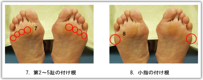 親指 痛い の の 足 裏 足の裏を押すと痛い時は要注意！足底腱膜炎の症状と治療方法とは？